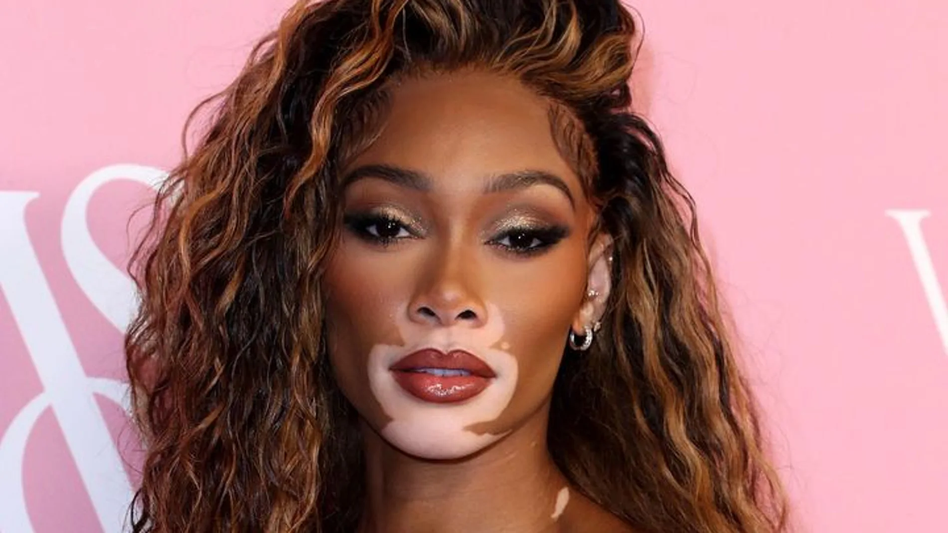 Winnie Harlow, modelo con vitíligo