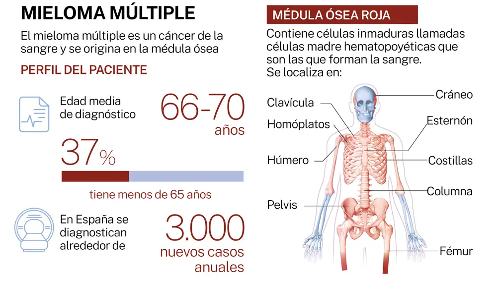 Mieloma 2023