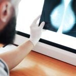 El tratamiento de cáncer de mama ha cambiado su paradigma con más curaciones, supervivencia y calidad de vida