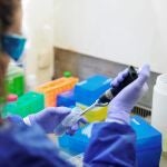 GRAF8075. MADRID (ESPAÑA), 11/07/2018.- Investigadores de Microbiología del Instituto de Investigación del Hospital 12 de Octubre, en la imagen, explican cómo han descubierto que tres supervivientes de la última epidemia de ébola poseen unos anticuerpos, denominados Unicornio, que abren una nueva vía para el diseño de una vacuna universal.-EFE/Diego Pérez Cabeza