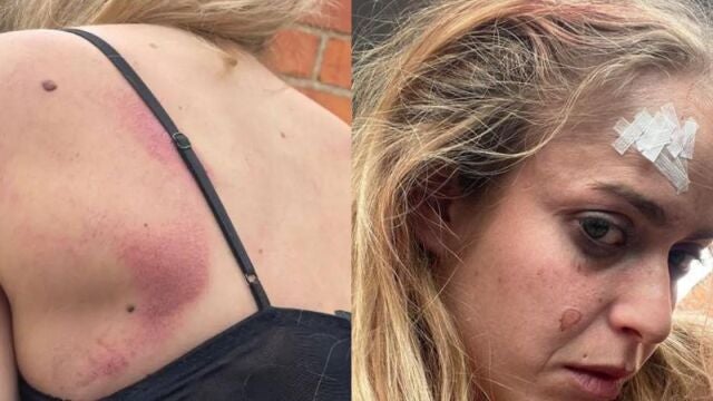 Joven agredida en Castellón tras defender a una amiga