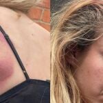 Joven agredida en Castellón tras defender a una amiga