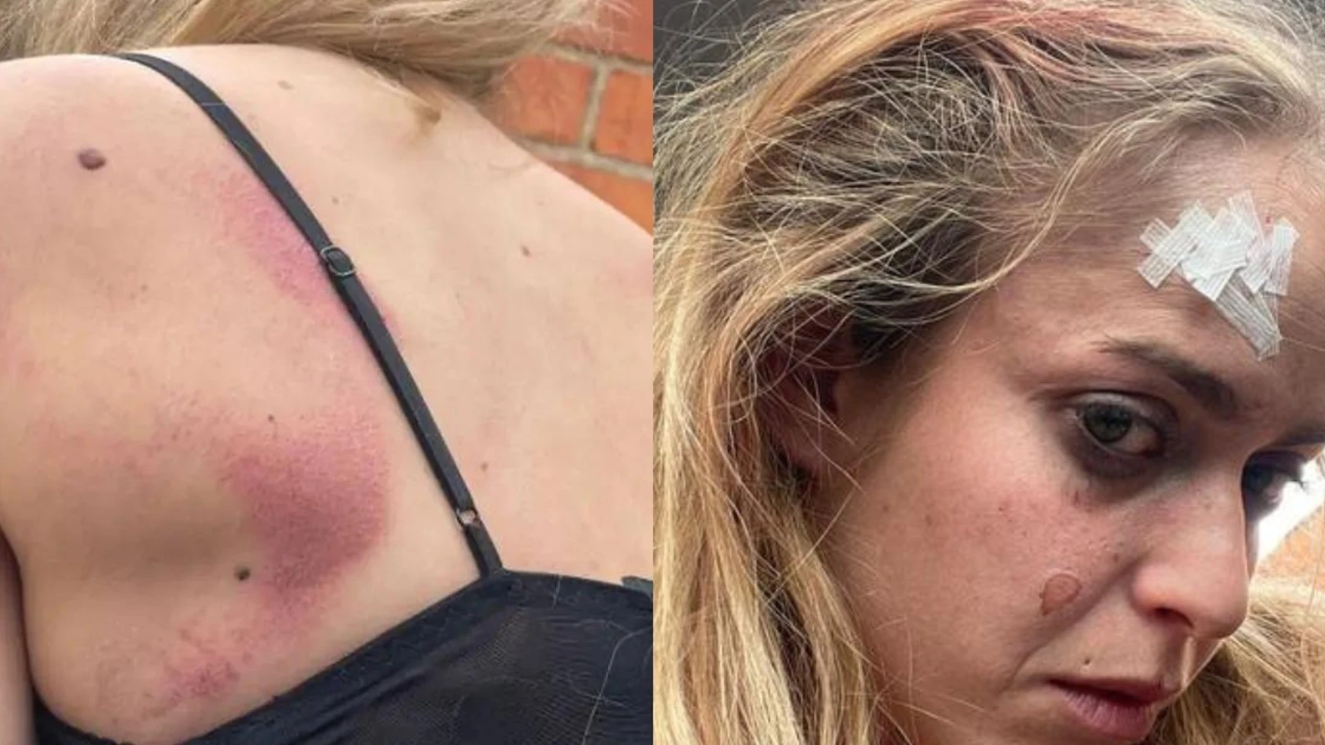 Joven agredida en Castellón tras defender a una amiga