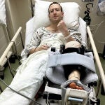 Mark Zuckerberg, ha revelado en una publicación de Instagram que sufrió una rotura del ligamento cruzado anterior mientras entrenaba "para una pelea competitiva de MMA a principios del próximo año".