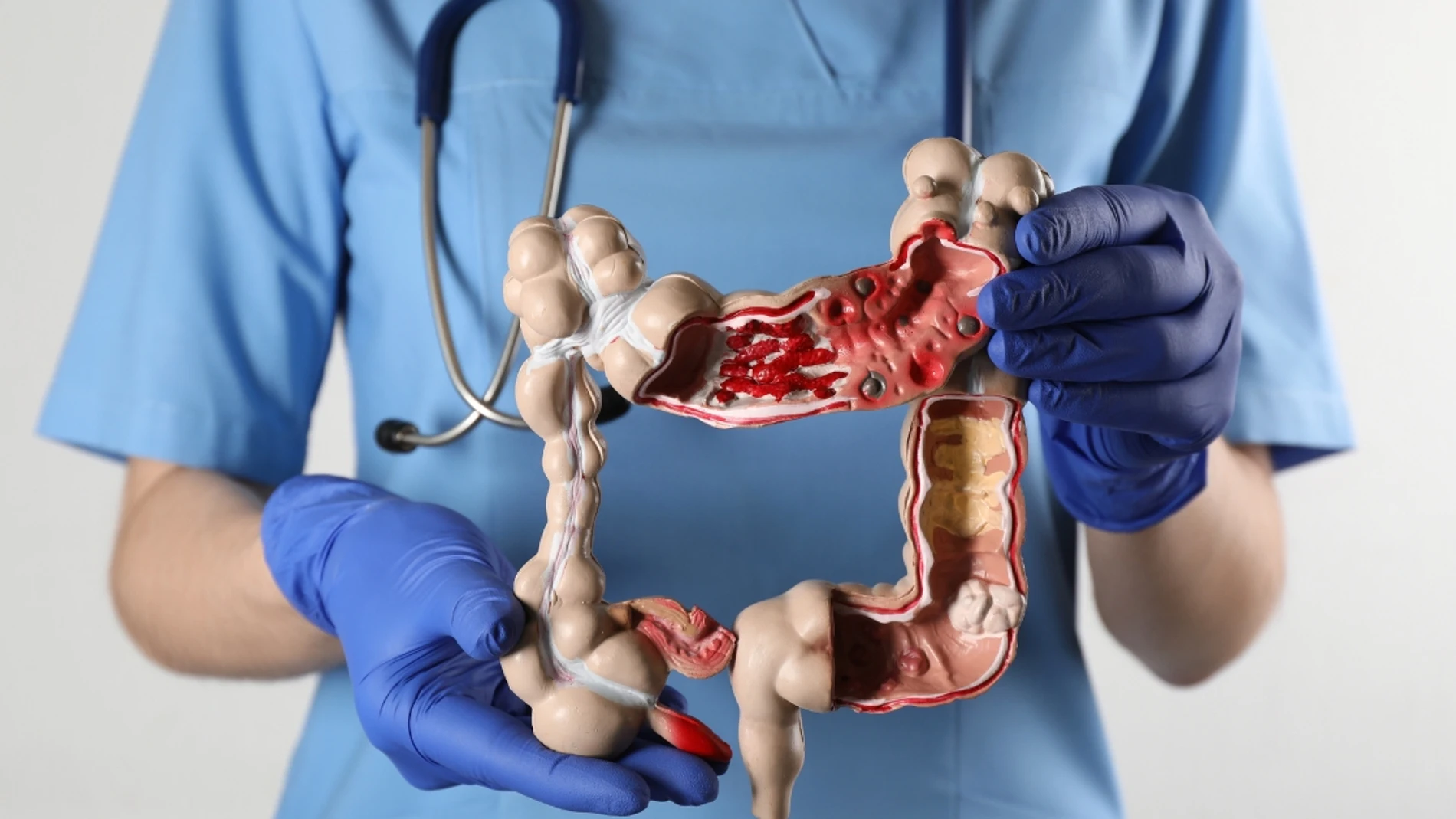 Condenan al Servicio Cántabro de Salud a indemnizar con 30.000 euros al viudo de una joven fallecida por cáncer de colon