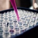 La tecnología CRISPR permite encontrar una secuencia específica dentro del ADN y editar el genoma de las células madre sanguíneas del propio paciente