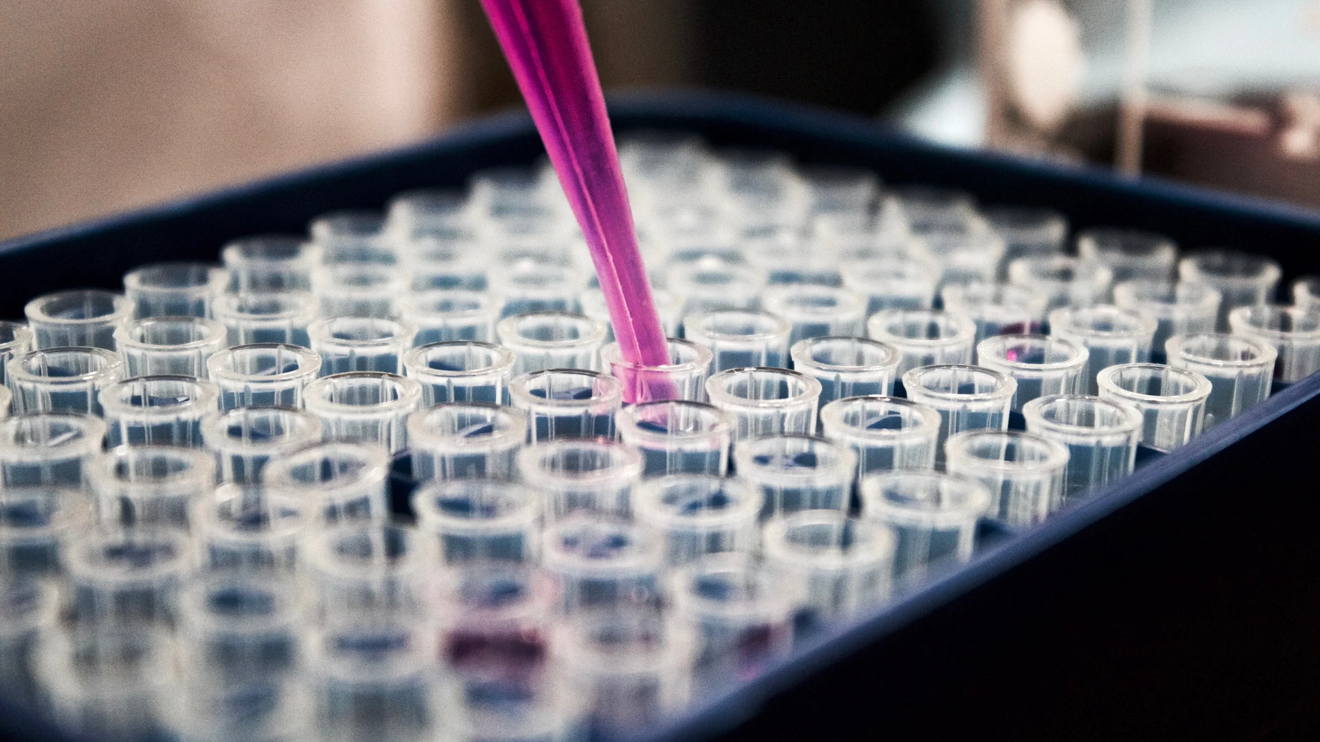 La tecnología CRISPR permite encontrar una secuencia específica dentro del ADN y editar el genoma de las células madre sanguíneas del propio paciente