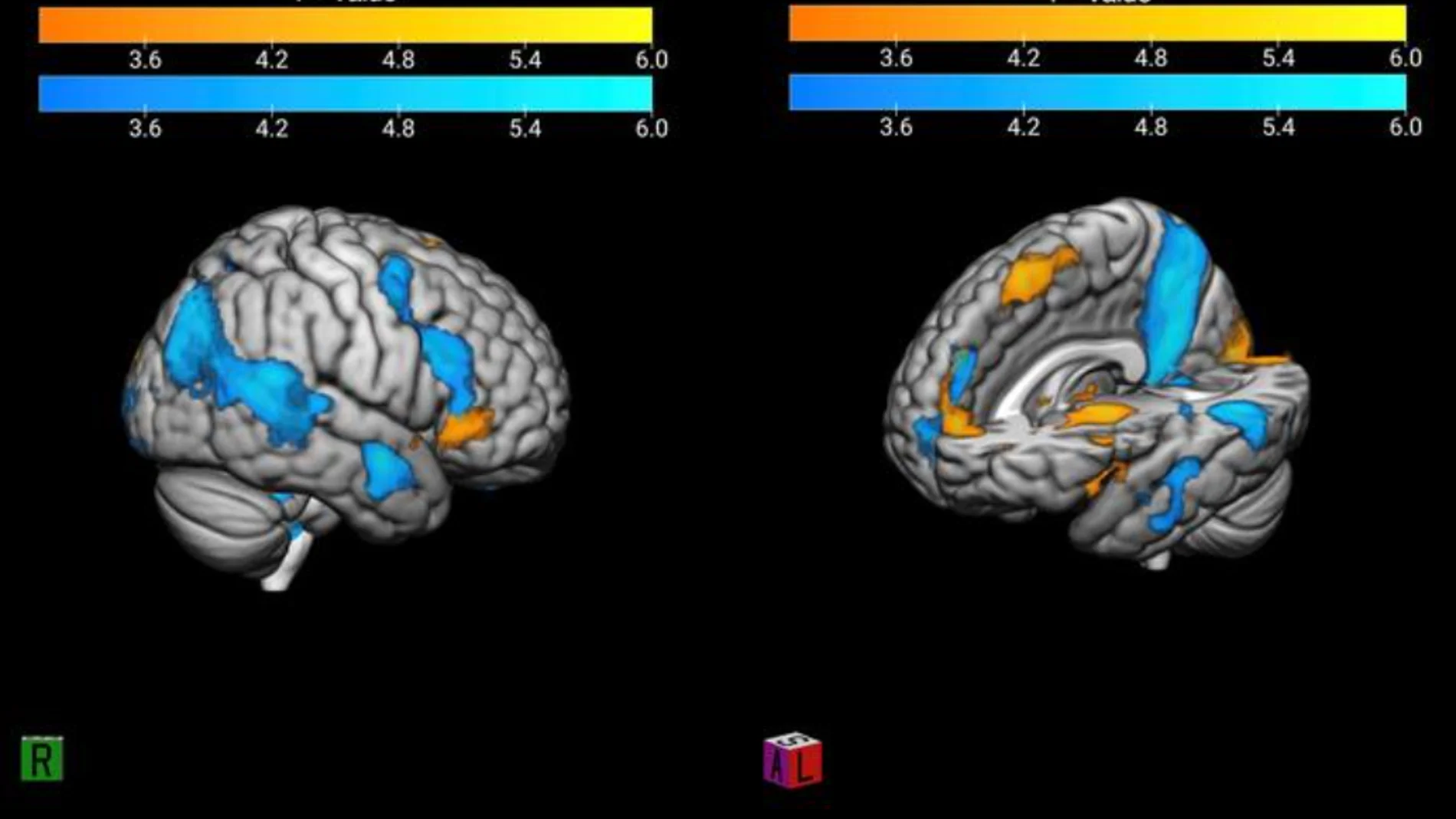 Cerebro