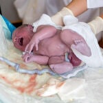 Unos 13 millones de bebés nacen de forma prematura