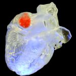Se ha probado para selllar un corazón y reemplazar una sección ósea