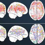 Efectos en la cnectividad neuronal antes (arriba) y después de usar ketamina. 