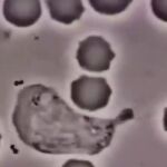 El vídeo que muestra qué ocurre en tu sangre cuando entra una bacteria