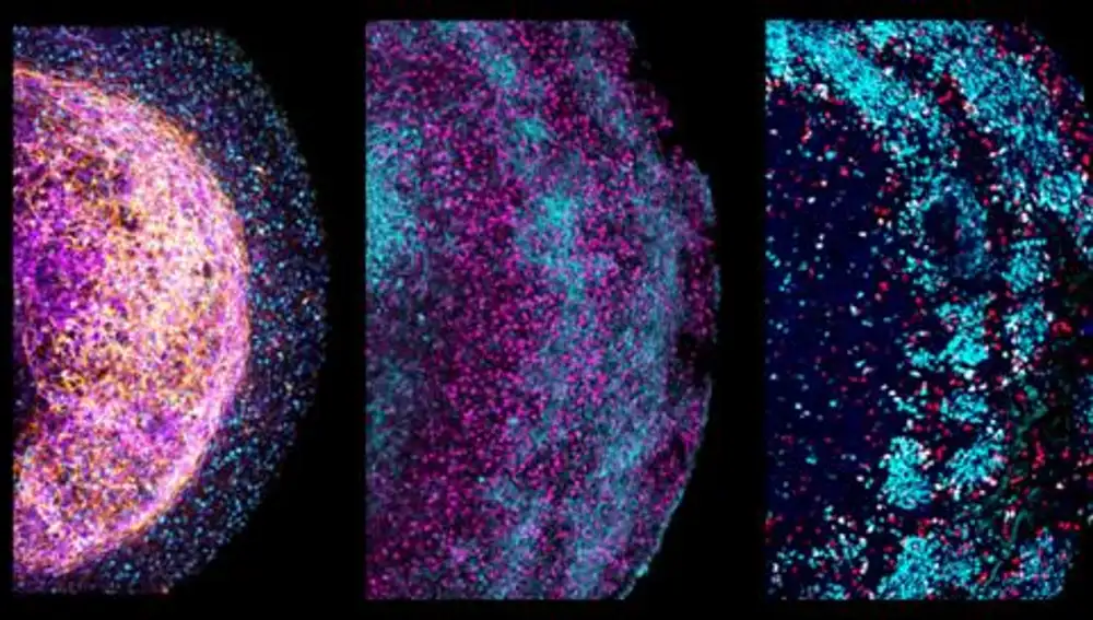 Diferentes partes del organoides en detalle