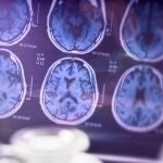 el desempleo y las pérdidas económicas se asocian con diferencias estructurales en el cerebro
