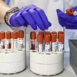  Personal técnico de laboratorio prepara unas muestras para analizar.