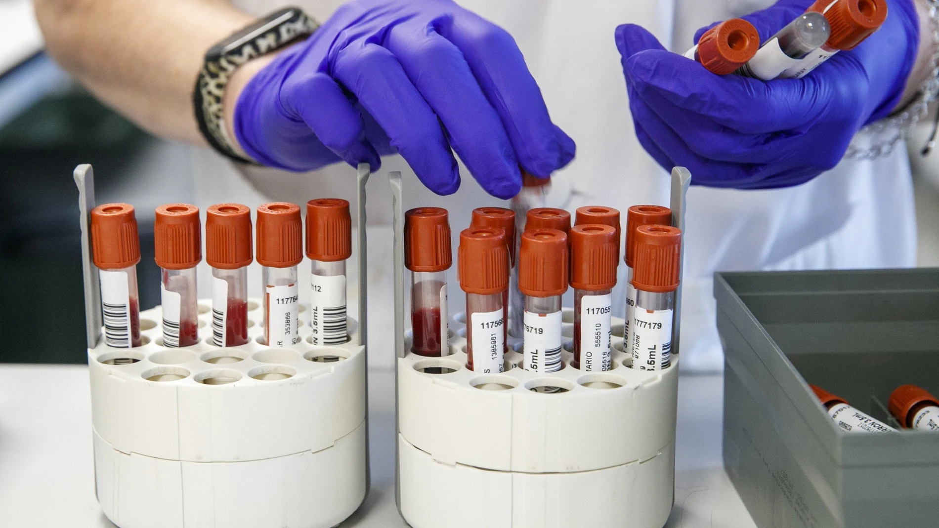Personal técnico de laboratorio prepara unas muestras para analizar.
