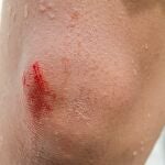 Existe una relación directa entre nuestra percepción del tiempo y la velocidad de curación de heridas