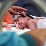Bebé prematuro en una incubadora