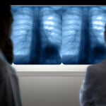 El nuevo medicamento aprobado por Sanidad ha sido fabricado por la farmacéutica Bristol Myers Squibb