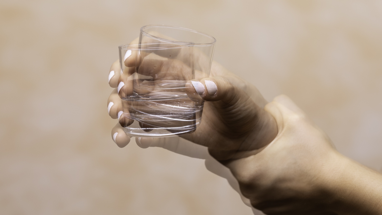 Una terapia génica logra "revertir siete años" el estado de personas con párkinson moderado