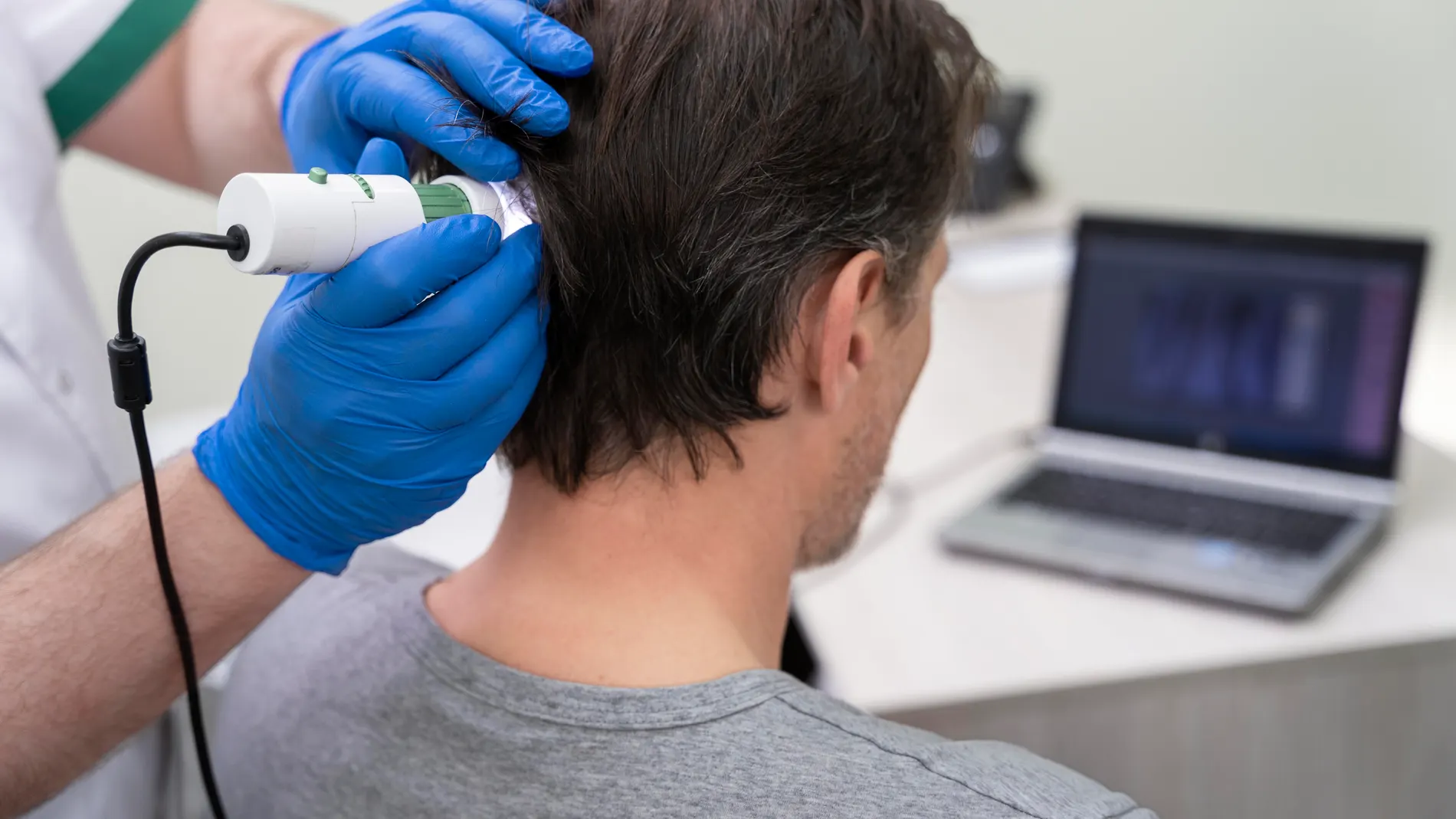 La alopecia es un problema dermatológico y según los especialistas en esta afección, los tricólogos, se puede y se debe combatir cuando afecta a la calidad de vida