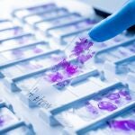 Los patólogos tienen un papel crucial en el diagnóstico preciso