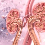 Fibrosis renal