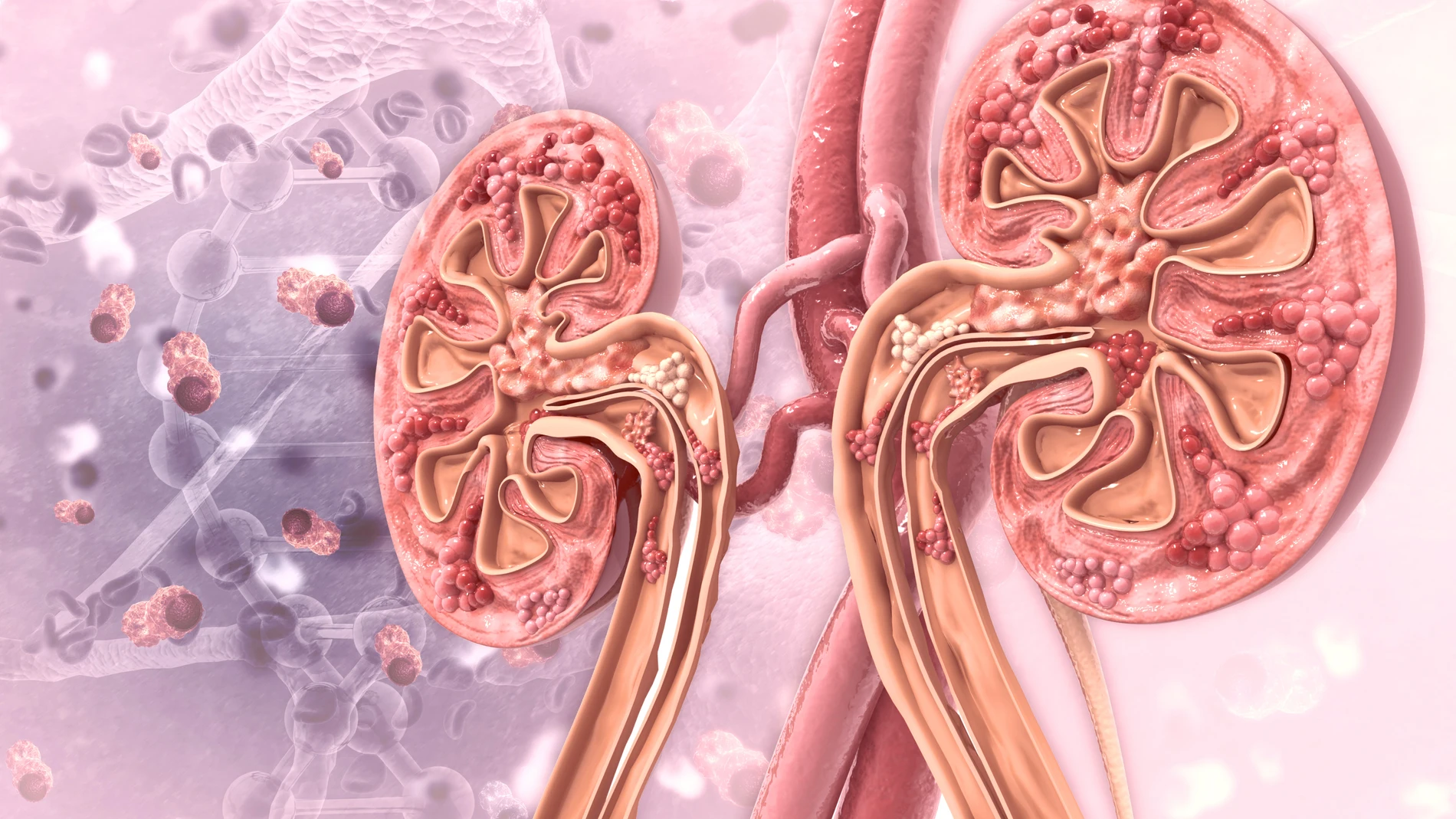 Fibrosis renal