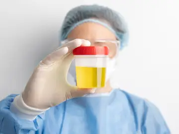 Un estudio descubre que una medicina da positivo en las pruebas de orina para drogas Prueba test orina