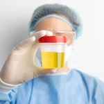 Un estudio descubre que una medicina da positivo en las pruebas de orina para drogas