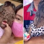 La extraña enfermedad de Adik Missclyen, conocida como hipertricosis, ha dado la vuelta al mundo