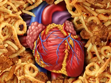 Los alimentos ultraprocesados son convenientes y económicos, pero su consumo excesivo se ha asociado con una serie de problemas de salud Los alimentos ultraprocesados son convenientes y económicos, pero su consumo excesivo se ha asociado con una serie de problemas de salud