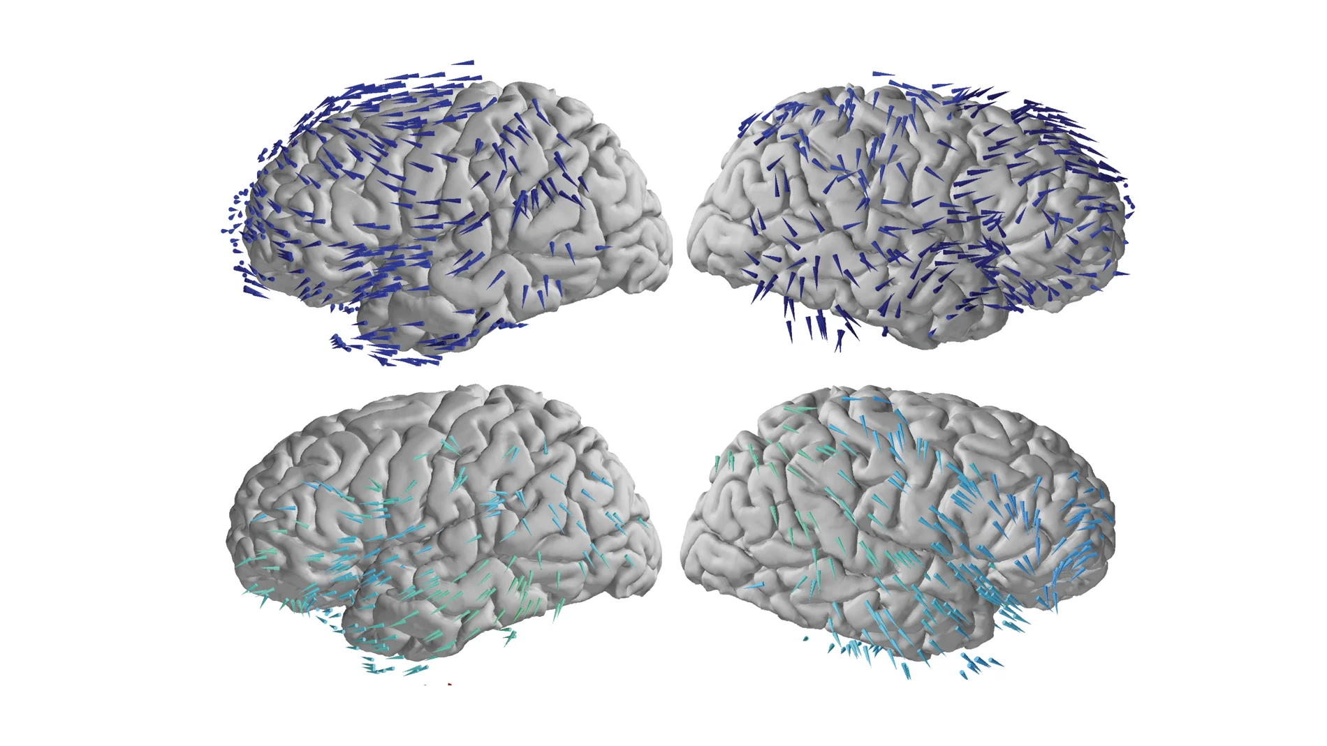 Cerebro memoria