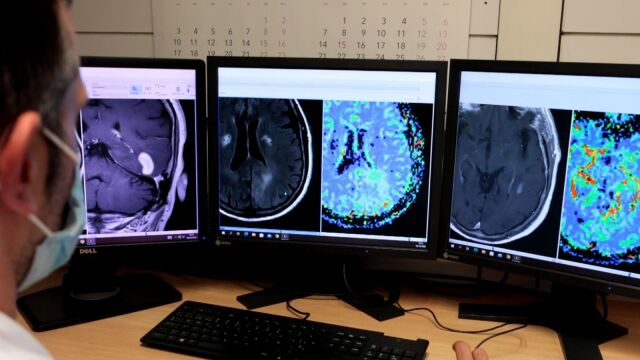 Imágenes de resonancia magnética del cerebro