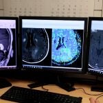 Imágenes de resonancia magnética del cerebro