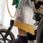 Problemas de desabastecimiento de bolsas de orina para dependientes