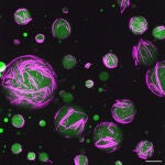Células artificiales con su citoesqueleto en fucsia.