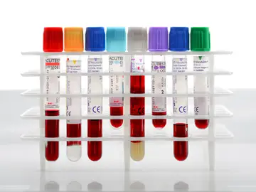 Análisis de sangre Análisis de sangre