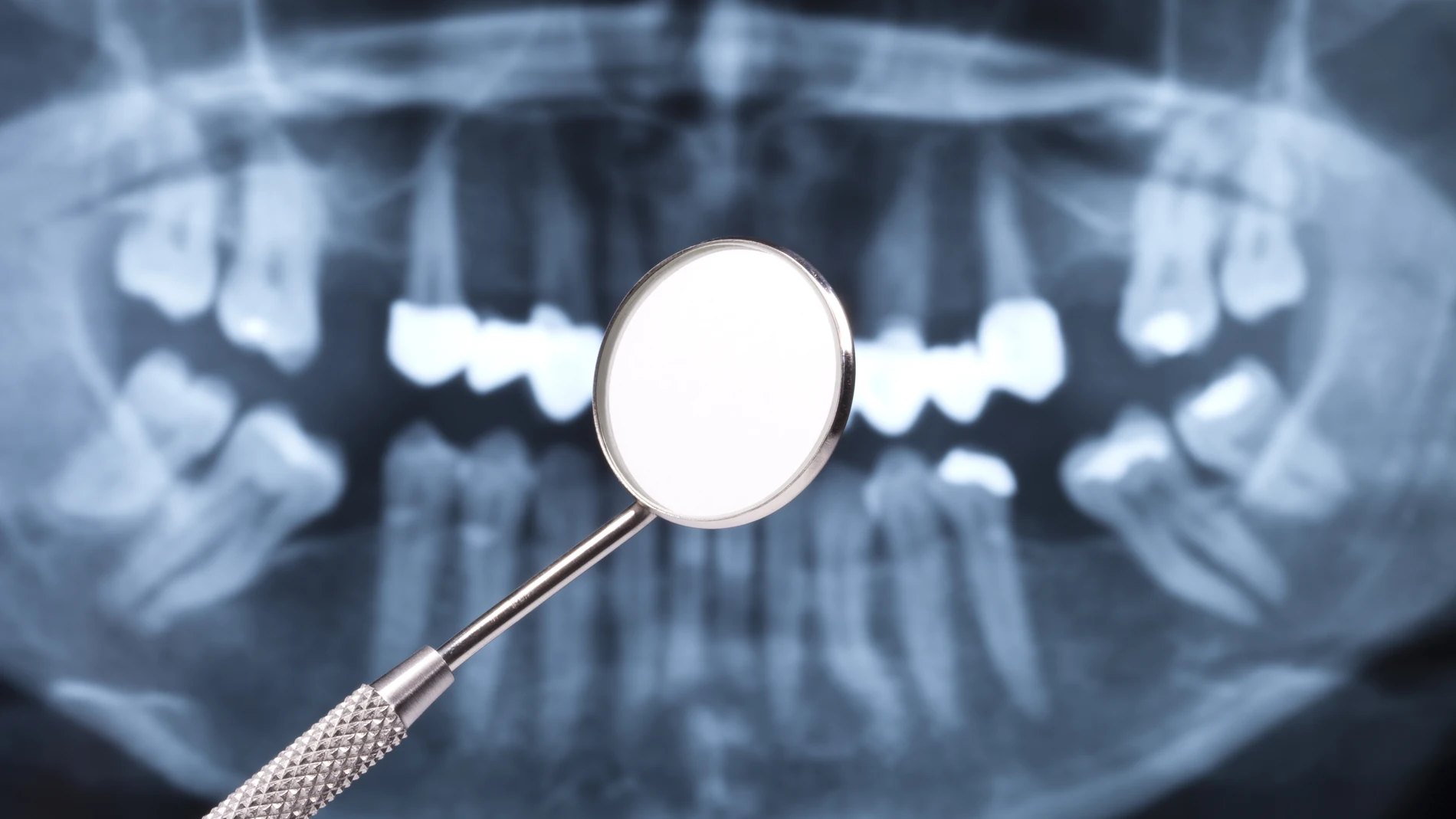 Medicina regenerativa en odontología