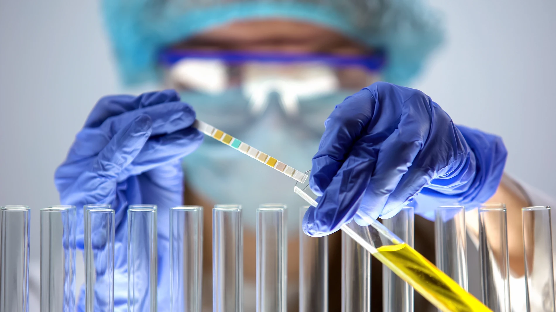 Análisis de orina en la detección del cáncer de vejiga