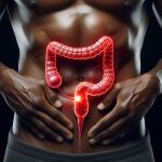 El cáncer de colon y recto aumenta en personas jóvenes, adolescentes y en niños