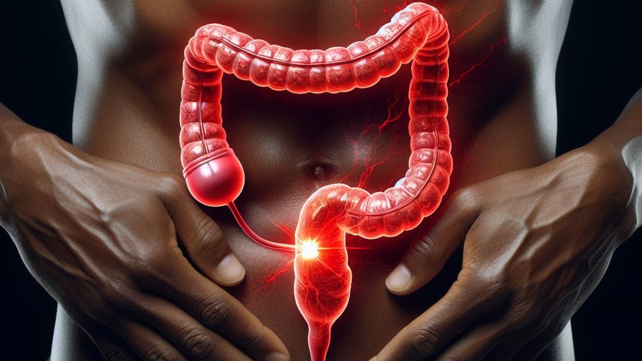 El cáncer de colon se dispara entre los menores de 50: lo que la ciencia sospecha que está pasando