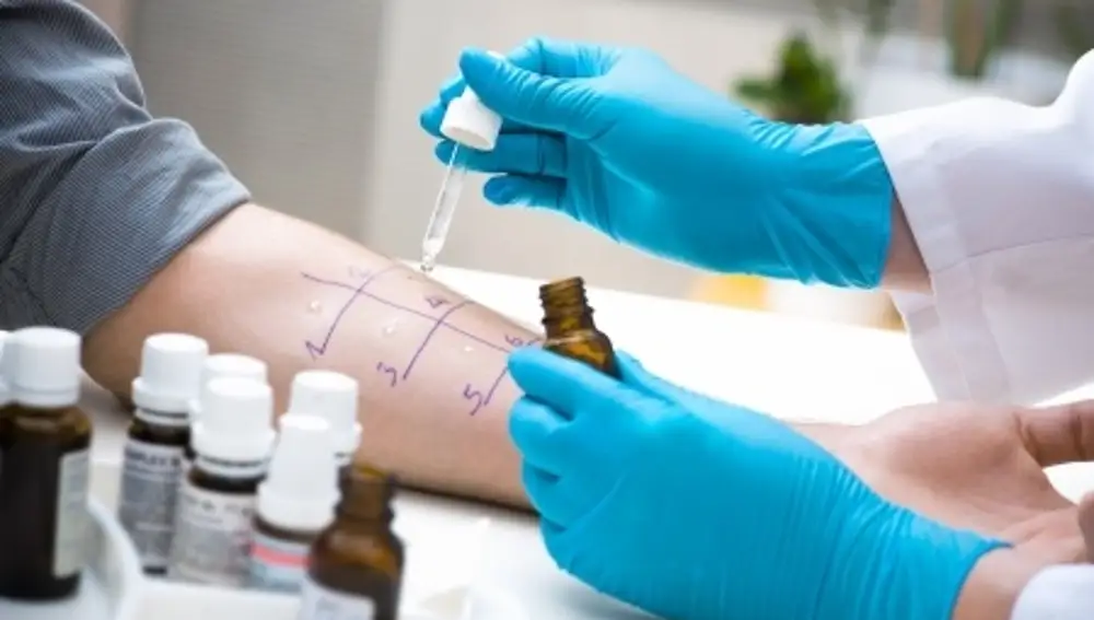 Prueba médica para la detección de alergias