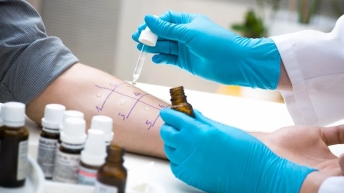 Prueba médica para la detección de alergias
