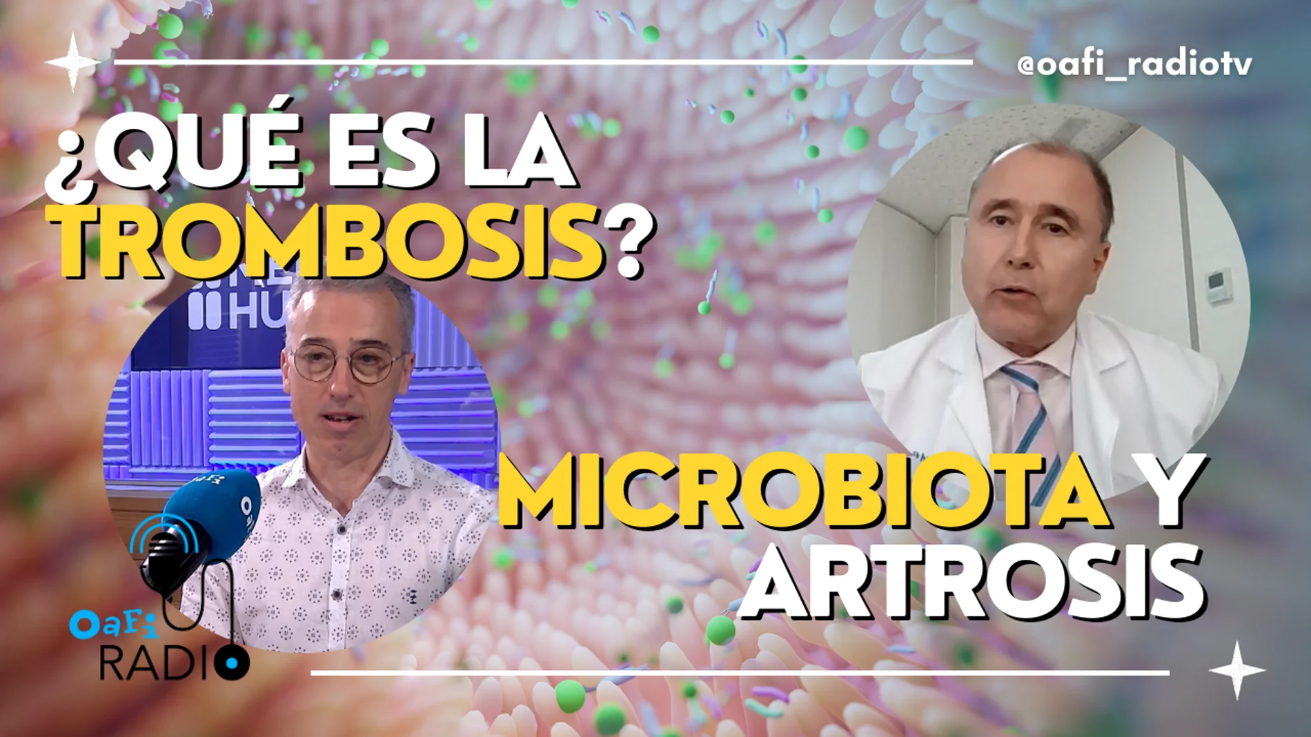 EL SECRETO ESTÁ EN NUESTRO INTESTINO: MICROBIOTA Y ARTROSIS + DESCUBRIENDO LA TROMBOSIS
