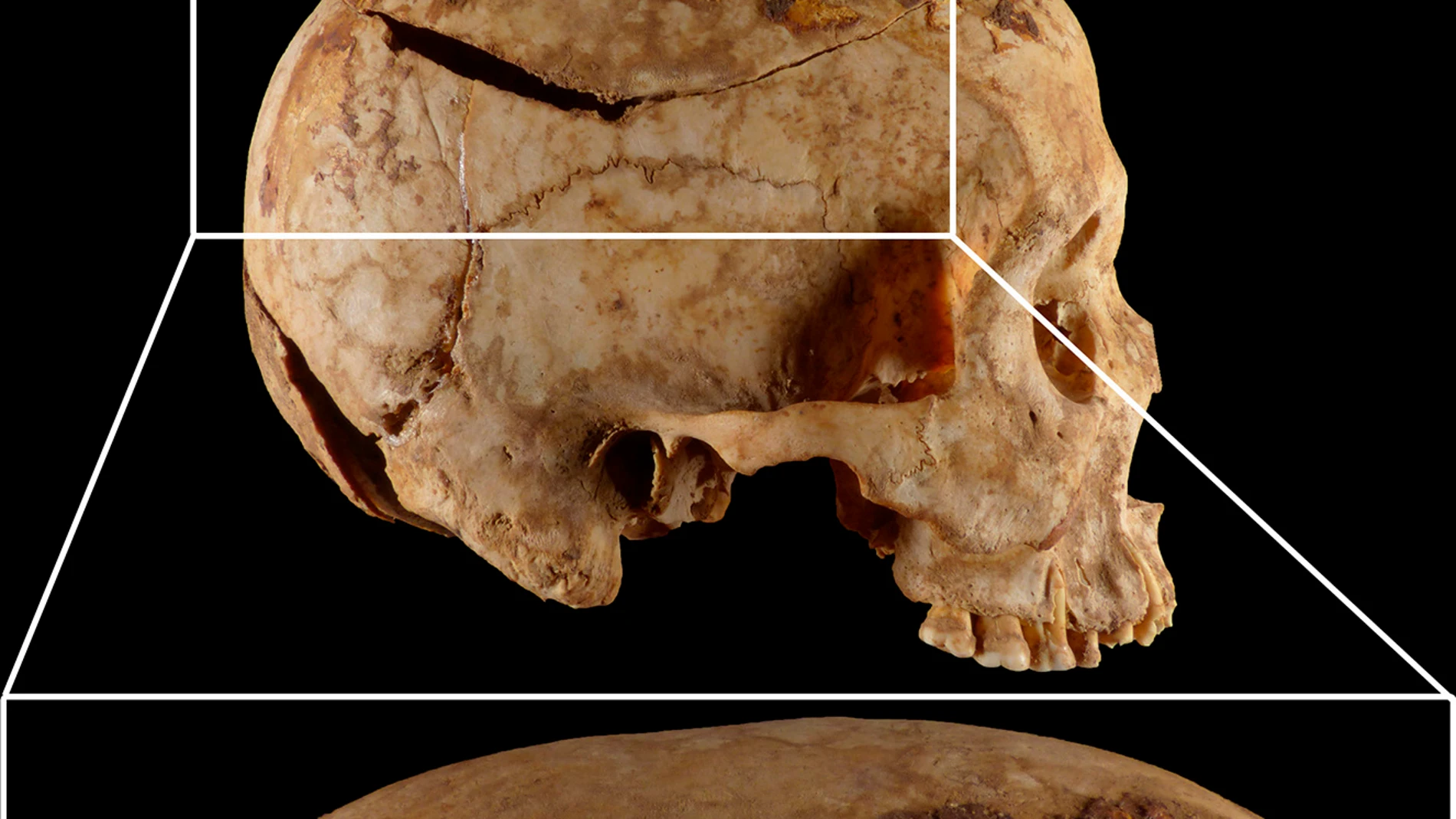 Imagen compuesta de uno de los cráneos estudiados, procedente de la necrópolis de Qubbet el-Hawa