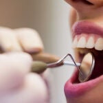 Dientes