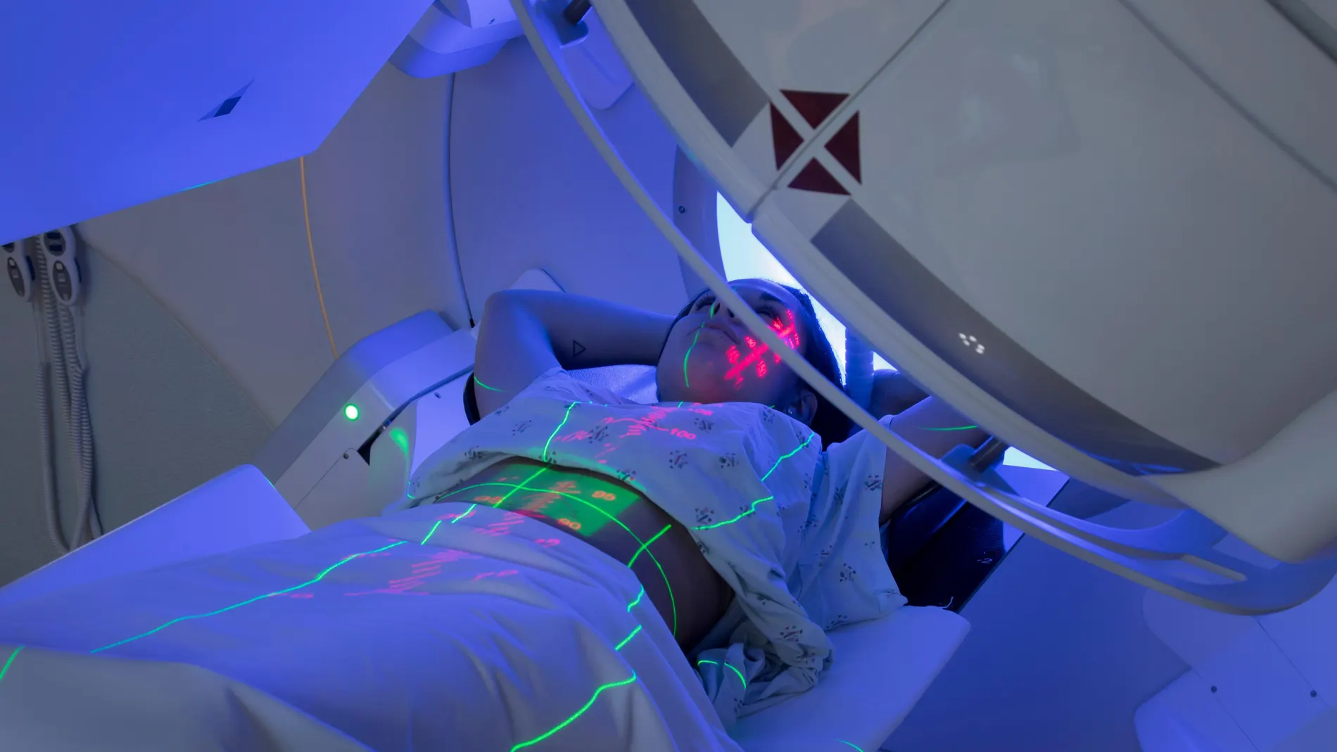 La Plataforma de Pacientes de radioterapia