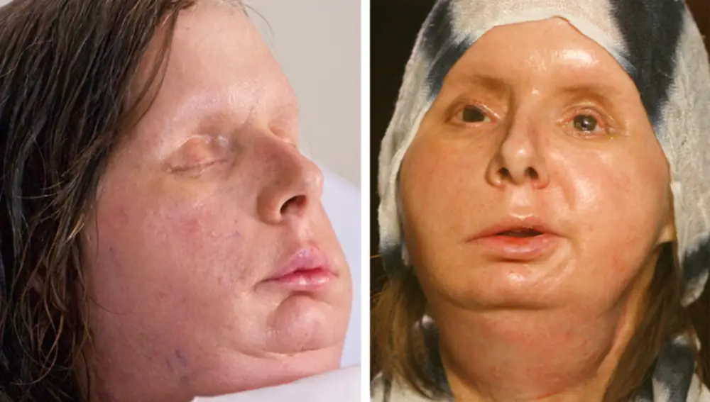 Charla Nash sigue luchando por reconstruir su vida