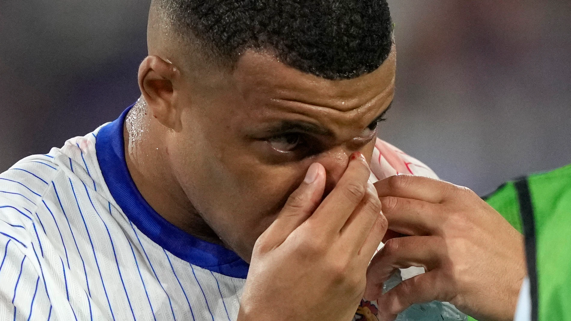 Kylian Mbappe of France holds his nose after suffering an injury during a Group D match between Austria and France at the Euro 2024 soccer tournament in Duesseldorf, Germany, Monday, June 17, 2024. (AP Photo/Martin Meissner)